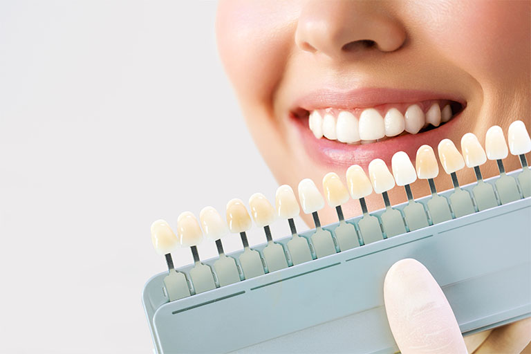 Clinica dental maestro. Comparación de blancos en blanqueamiento dental