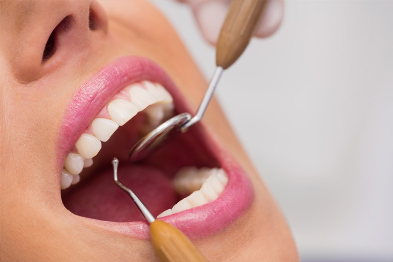 La endodoncia ¿Sabes en qué consiste? Clínica Maestro, tu clínica dental en Oviedo