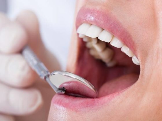 Influencias del tabaco en las enfermedades periodontales. Clínica dental en Oviedo.