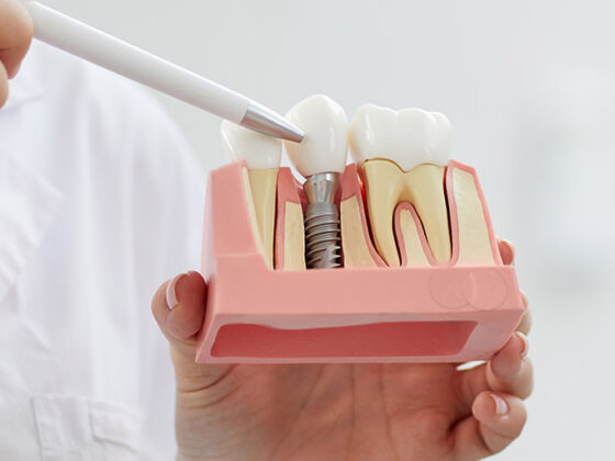 Clínica Dental Maestro. Un implante dental puede dar fin a los riesgos cardiovasculares provocados por la falta del diente