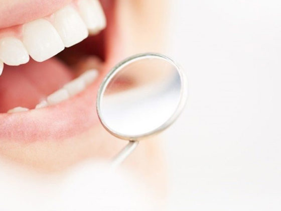 Clínica Dental Maestro. Clínica Dental en Oviedo. Te damos los tips sobre carillas dentales que necesitas.