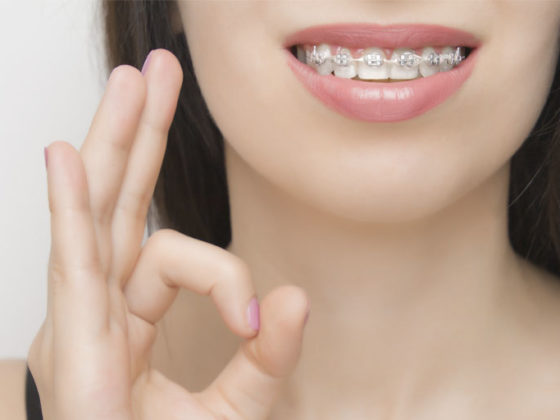 Ortodoncia e inflamación de encías