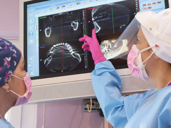 osteointegración de un implante dental