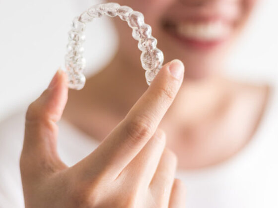 ¿Qué es la ortodoncia invisible Invisalign?  Invisalign - Clinica Dental en Oviedo