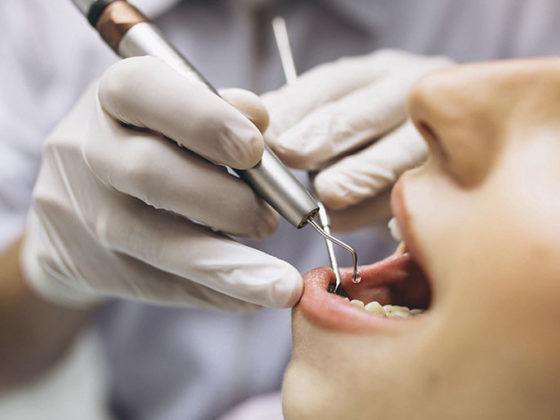 Clínica Dental Maestro. Persona en tratamiento contra la periimplantitis