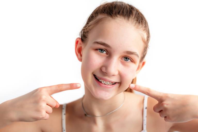 Ortodoncia infantil ¿Cuándo empezar (2)