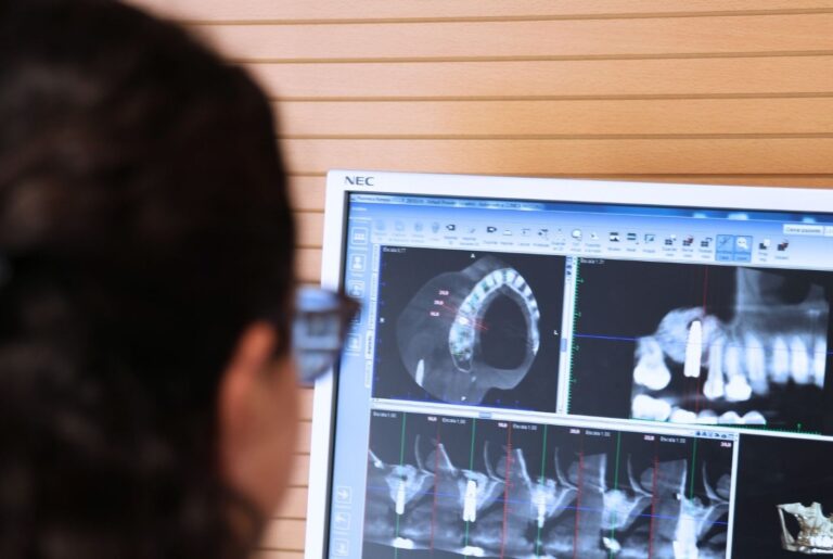 superar miedo implantes dentales