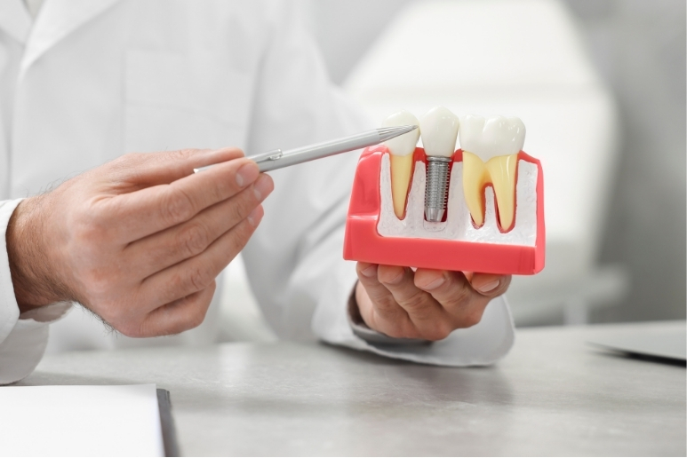 implante dental se mueve
