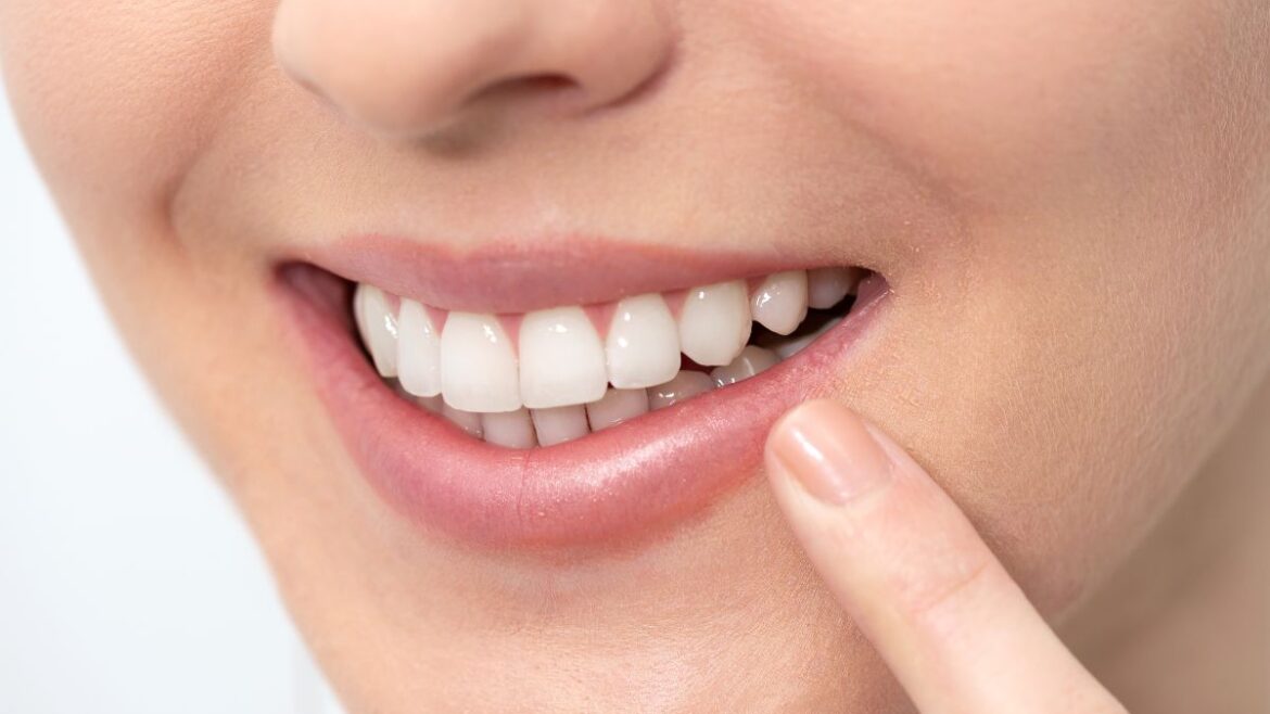 Cómo tener dientes más blancos. Clínica Dental Maestro. Clínica dental Oviedo