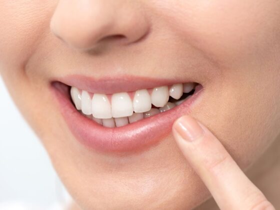 Cómo tener dientes más blancos. Clínica Dental Maestro. Clínica dental Oviedo