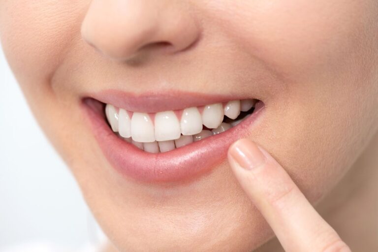 Cómo tener dientes más blancos. Clínica Dental Maestro. Clínica dental Oviedo