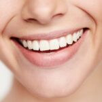 ¿Qué soluciones existen para un frenillo labial corto - Clínica Dental Maestro - Clínica dental Oviedo