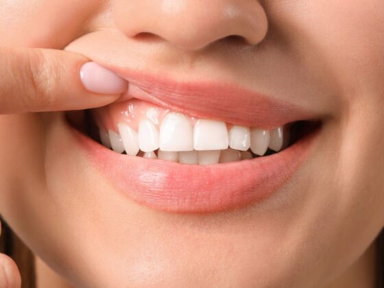 Traumatismos dentales Cómo identificarlos y tratarlos. Clinica Dental en Oviedo Dental Maestro