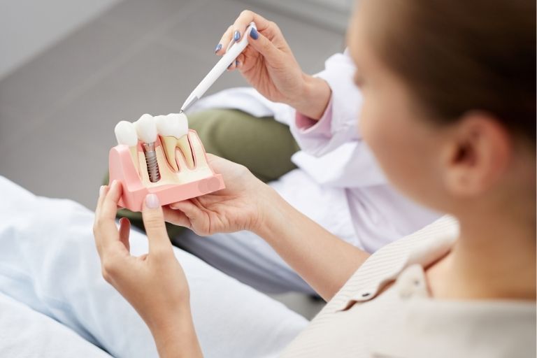 los implantes dentales pueden provocar caries Implantes dentales en oviedo
