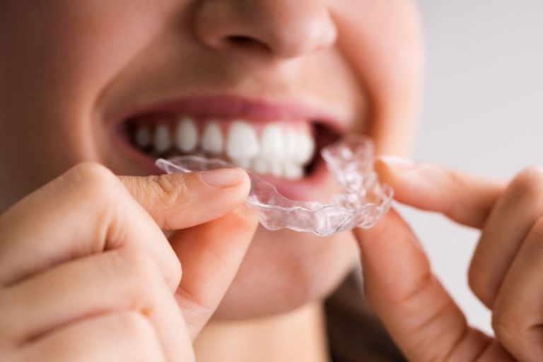 el bruxismo clinica dental en Oviedo