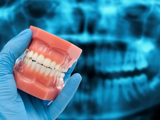 oclusión dental dentista en Oviedo